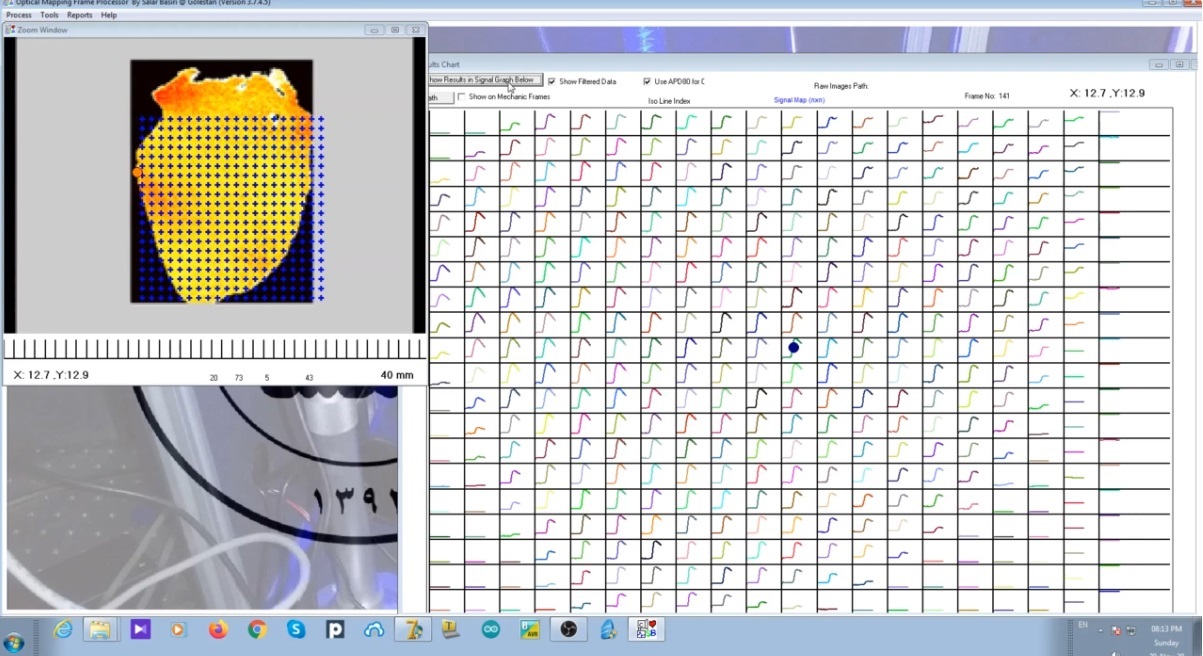 نرم‌افزار اختصاصی پردازش تصویر و سیگنال اپتیکال مپینگ رهسا - محاسبه APD80 و Conduction Velocity